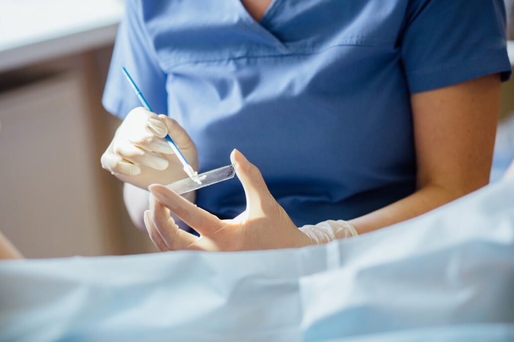 Todo sobre la citología vaginal