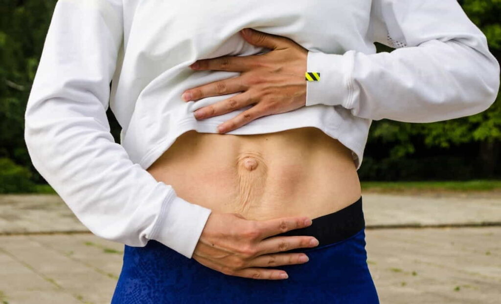 Diástasis abdominal: ¿qué es?